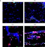 Rabbit IgG (H+L) Cross-Adsorbed Secondary Antibody in Immunocytochemistry (ICC/IF)