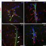 Rabbit IgG (H+L) Cross-Adsorbed Secondary Antibody in Immunohistochemistry (IHC)