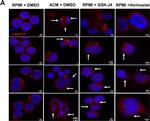 Rabbit IgG (H+L) Cross-Adsorbed Secondary Antibody in Immunocytochemistry (ICC/IF)