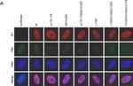 Rabbit IgG (H+L) Highly Cross-Adsorbed Secondary Antibody in Immunocytochemistry (ICC/IF)