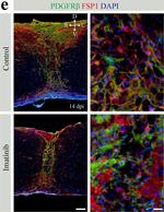 Rabbit IgG (H+L) Highly Cross-Adsorbed Secondary Antibody in Immunohistochemistry (IHC)