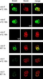 Rabbit IgG (H+L) Highly Cross-Adsorbed Secondary Antibody in Immunohistochemistry (PFA fixed) (IHC (PFA))