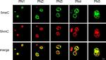 Rabbit IgG (H+L) Highly Cross-Adsorbed Secondary Antibody in Immunohistochemistry (PFA fixed) (IHC (PFA))