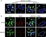 Rabbit IgG (H+L) Highly Cross-Adsorbed Secondary Antibody in Immunohistochemistry (PFA fixed) (IHC (PFA))