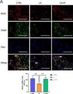 Rabbit IgG (H+L) Highly Cross-Adsorbed Secondary Antibody in Immunocytochemistry (ICC/IF)