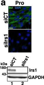 Rabbit IgG (H+L) Highly Cross-Adsorbed Secondary Antibody in Immunocytochemistry (ICC/IF)