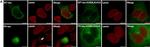 Rabbit IgG (H+L) Highly Cross-Adsorbed Secondary Antibody in Immunocytochemistry (ICC/IF)