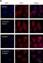 Rabbit IgG (H+L) Highly Cross-Adsorbed Secondary Antibody in Immunocytochemistry (ICC/IF)