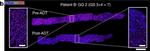 Rabbit IgG (H+L) Highly Cross-Adsorbed Secondary Antibody in Immunohistochemistry (Paraffin) (IHC (P))