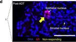 Rabbit IgG (H+L) Highly Cross-Adsorbed Secondary Antibody in Immunohistochemistry (Paraffin) (IHC (P))