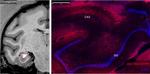 Rabbit IgG (H+L) Highly Cross-Adsorbed Secondary Antibody in Immunohistochemistry (IHC)