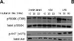 Rabbit IgG (H+L) Cross-Adsorbed Secondary Antibody in Western Blot (WB)