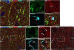 Mouse IgG (H+L) Highly Cross-Adsorbed Secondary Antibody in Immunohistochemistry (IHC)