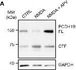 Rabbit IgG (H+L) Secondary Antibody in Western Blot (WB)