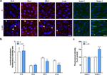 ICAM-1 Antibody in Immunocytochemistry (ICC/IF)