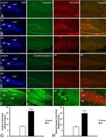 Caspase 3 Antibody in Immunohistochemistry (IHC)