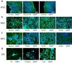 Nestin Antibody in Immunocytochemistry (ICC/IF)