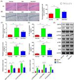 CHOP Antibody in Western Blot (WB)