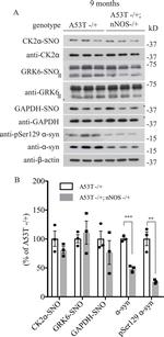 GAPDH Antibody in Western Blot (WB)