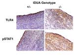 Phospho-STAT1 (Tyr701) Antibody in Immunohistochemistry (IHC)