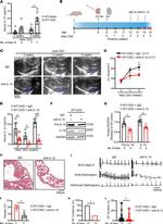 IL-1 beta Antibody in Neutralization (Neu)