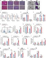 IFN gamma Antibody in Flow Cytometry (Flow)