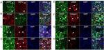 Desmin Antibody in Immunohistochemistry (IHC)