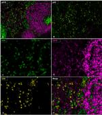 CD4 Antibody in Immunohistochemistry (Paraffin) (IHC (P))