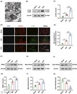 Parkin Antibody in Western Blot (WB)