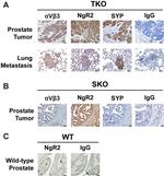 Synaptophysin Antibody in Immunohistochemistry (IHC)