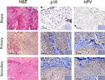 CD45 Antibody in Immunohistochemistry (IHC)