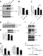 beta Amyloid Antibody in Western Blot (WB)