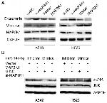 MEKK1 Antibody in Western Blot (WB)