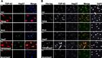 6x-His Tag Antibody in Immunocytochemistry (ICC/IF)