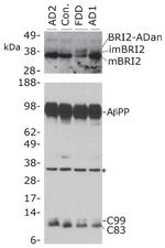 beta Amyloid Antibody in Western Blot (WB)