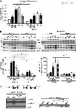 NFkB p65 Antibody in Western Blot (WB)