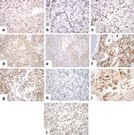 Phospho-AKT1 (Ser473) Antibody in Immunohistochemistry (Paraffin) (IHC (P))