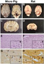 beta Amyloid Antibody in Immunohistochemistry (IHC)