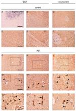 alpha Synuclein Antibody in Immunohistochemistry (IHC)