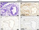 Alpha-Smooth Muscle Actin Antibody in Immunohistochemistry (IHC)