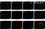 CD34 Antibody in Immunocytochemistry (ICC/IF)