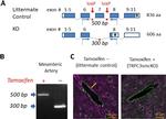 Alpha-Smooth Muscle Actin Antibody in Immunohistochemistry (IHC)