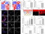 Alpha-Smooth Muscle Actin Antibody in Immunocytochemistry (ICC/IF)