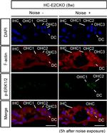 ERK1 Antibody in Immunohistochemistry (IHC)