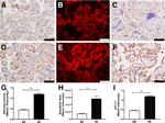 Nitrotyrosine Antibody in Immunohistochemistry (IHC)