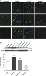 Phospho-PAK1/2/3 (Ser141) Antibody in Immunohistochemistry (IHC)