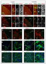 CD11b Antibody in Immunohistochemistry (PFA fixed) (IHC (PFA))