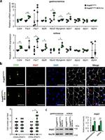 CD34 Antibody in Immunohistochemistry (IHC)