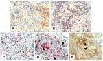 CD279 (PD-1) Antibody in Immunohistochemistry (IHC)