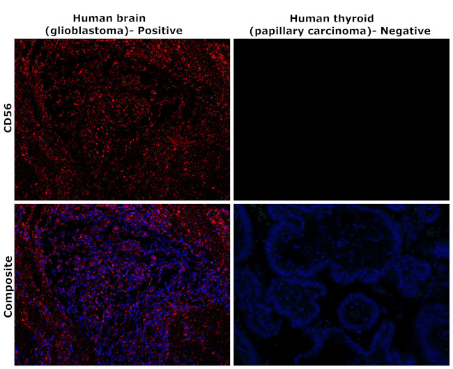 CD56 Antibody in Immunohistochemistry (Paraffin) (IHC (P))